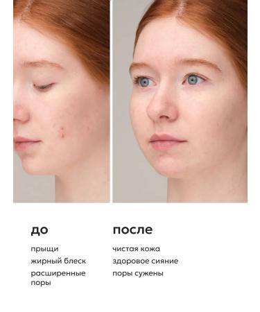 Likato professional Facial complex from acne facial cream - 2pcs - Buy Online on GoSupps.com