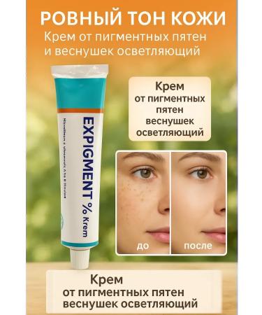 kosmosKS Cream remedy for freckles pigmentation - Buy Online on GoSupps.com