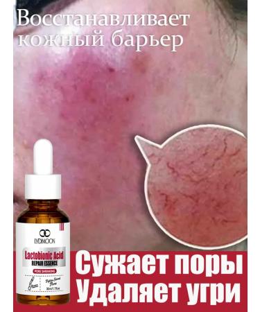 LYDIMOON Restoring serum narrows pores from acne