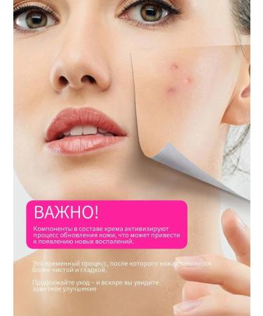 Djik professional Facial cream for acne with salicylic acid 50ml - Buy Online on GoSupps.com