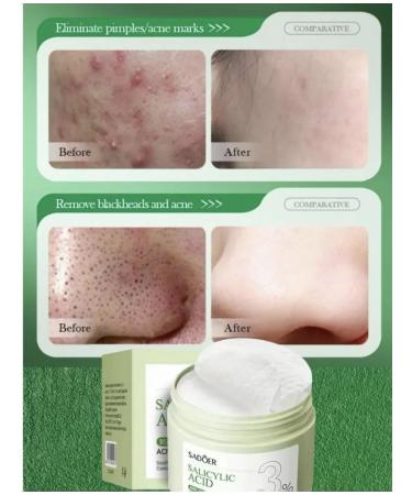 Ladys-Pretty Facial peeling piling discs cleansing Pads - Buy Online on GoSupps.com