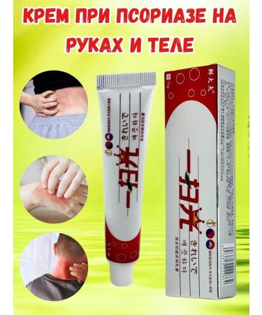 LATIBEAUTYFUL Psoriasis cream on hand and body