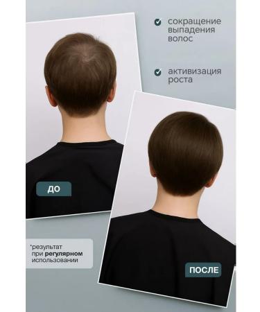 Siberia Nova Hair growth with rosemary and red pepper - Buy Online on GoSupps.com