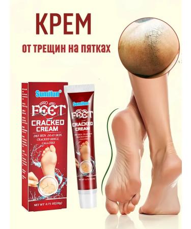 Barynch Cream-tool from cracks on heels healing legs peeling