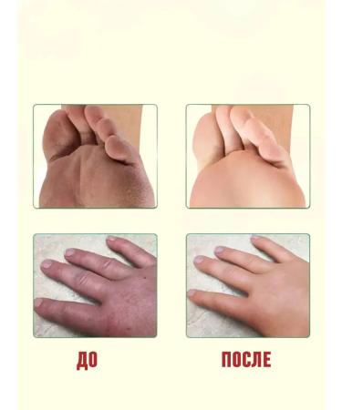 Barynch Cream-tool from cracks on heels healing legs peeling - Buy Online on GoSupps.com