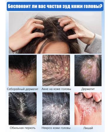 Shampoo for quickly eliminating itching and dandruff - Buy Online on GoSupps.com