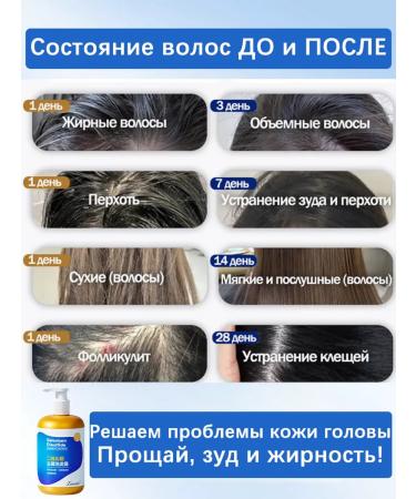 Shampoo for quickly eliminating itching and dandruff - Buy Online on GoSupps.com