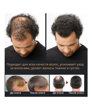 eelhoe Turn off the hair of a shampoo of the thickening to help growth - Buy Online on GoSupps.com