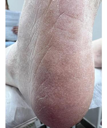 ROSILAK Gel-peeling for the skin of the arms of the legs is professional - Buy Online on GoSupps.com