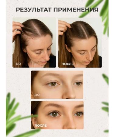 Biota Uzma oil 100% for hair growth 30 ml - Buy Online on GoSupps.com