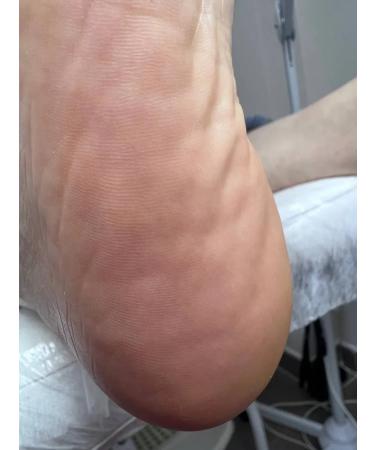 ROSILAK Cream for skin skin cleansing - Buy Online on GoSupps.com