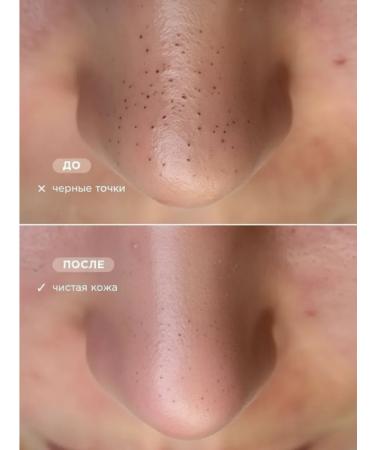 Teona Sharmis Enzymal peeling (Enzyme powder) - Buy Online on GoSupps.com