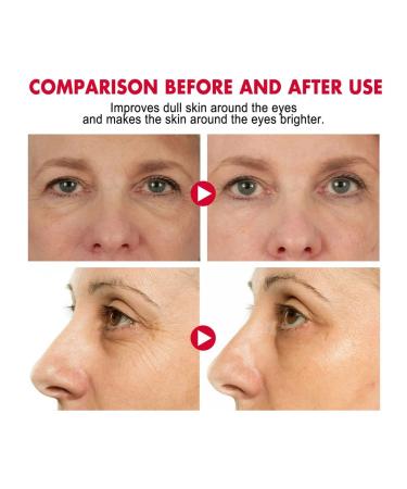 Eelhoe cream-footing for eyelids with retinol - Buy Online on GoSupps.com