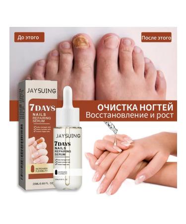 Wheezer to care for nails2 pcs