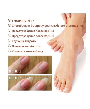Wheezer to care for nails2 pcs - Buy Online on GoSupps.com