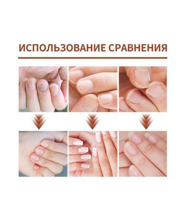 Wheezer to care for nails2 pcs - Buy Online on GoSupps.com