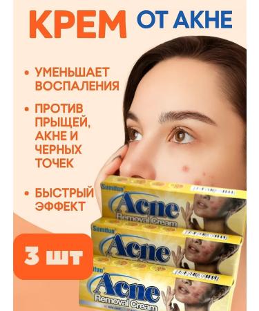 QUALITY Acne cream and acne with an antiseptic effect of 3pcs