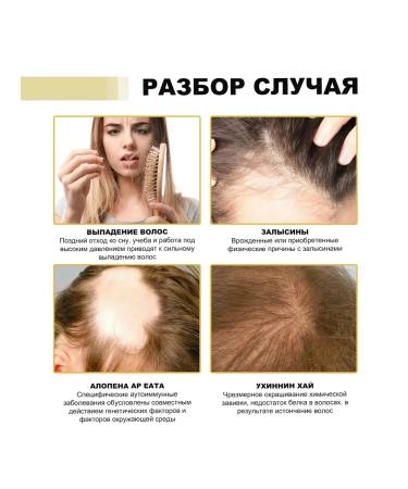 eelhoe Reduce hair loss Essential oil suppressive shine - Buy Online on GoSupps.com