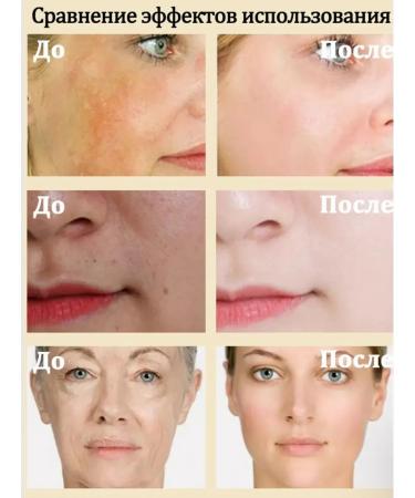 sadoer Face cream of anti -aging from wrinkles bleaching - Buy Online on GoSupps.com