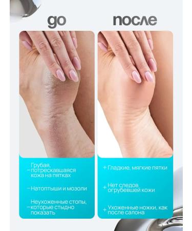 Totti Beauty Nano legs for legs with a pen + pencil-kit for legs - Buy Online on GoSupps.com