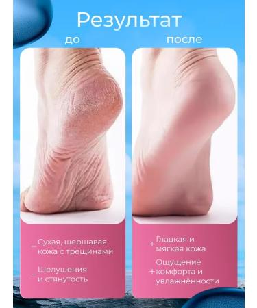 Totti Beauty Pencil-kit for hands and legs against cracks - Buy Online on GoSupps.com