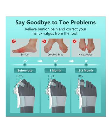 Big toe roll unloading bolts rotating - Buy Online on GoSupps.com