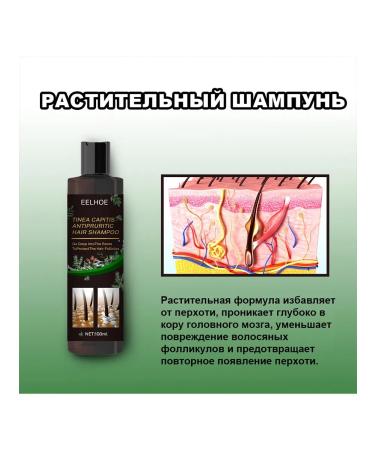 eelhoe Itching shampoo prevents hair loss - Buy Online on GoSupps.com
