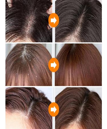 Dodoyuri intense shampoo against dandruff 300 ml - Buy Online on GoSupps.com