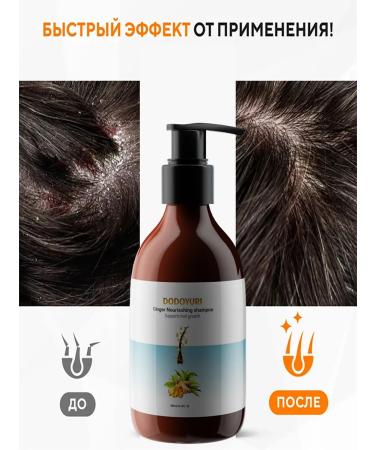 Dodoyuri intense shampoo against dandruff 300 ml - Buy Online on GoSupps.com