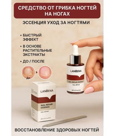 kosmosKS Remedy for nail fungus on the legs Essence Nail Care