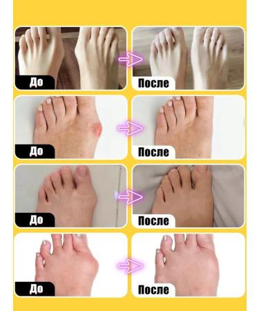 Bone ointment on the leg-55 g - Buy Online on GoSupps.com