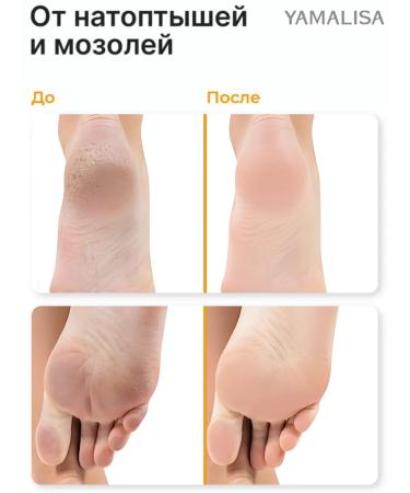 Yml stick for heels from cracks and dryness healing 1 pcs - Buy Online on GoSupps.com