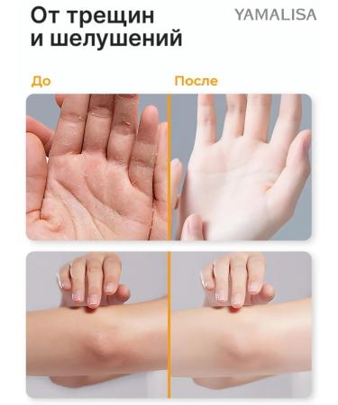 Yml stick for heels from cracks and dryness healing 1 pcs - Buy Online on GoSupps.com