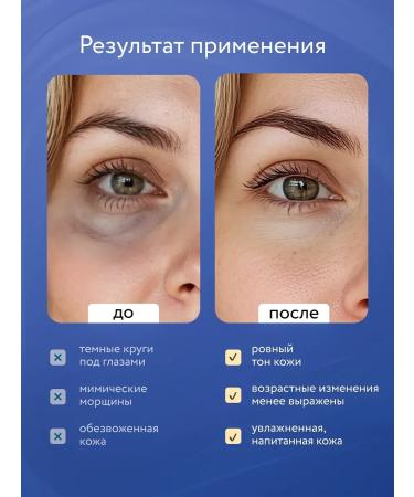 Caffeine Eye Cream for Dark Circles - Buy Online on GoSupps.com