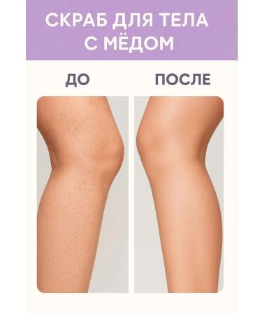 TopShopchik Body scrub anti -cellulite from stretch marks honey - Buy Online on GoSupps.com