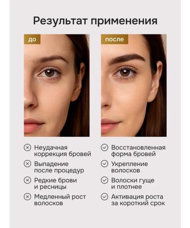 BROWXENNA Uzma oil for eyebrows and eyelashes - Buy Online on GoSupps.com