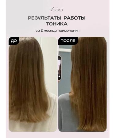 TonicX Hair growth tonic - Buy Online on GoSupps.com