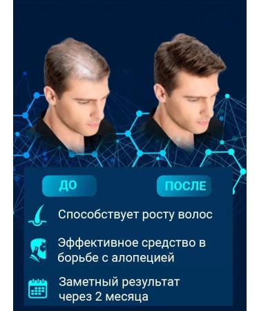 LotionPro Hair growth lotion 5% 4 pcs