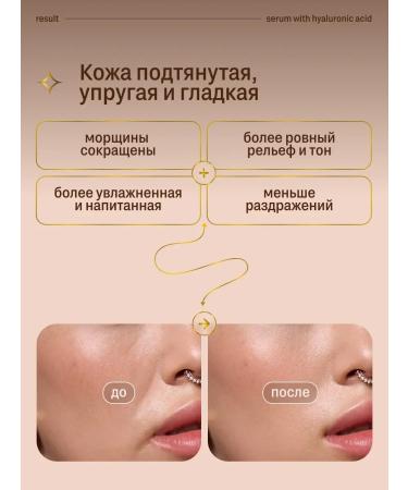 SeruZone Facial serum with hyaluronic acid 30 ml - Buy Online on GoSupps.com