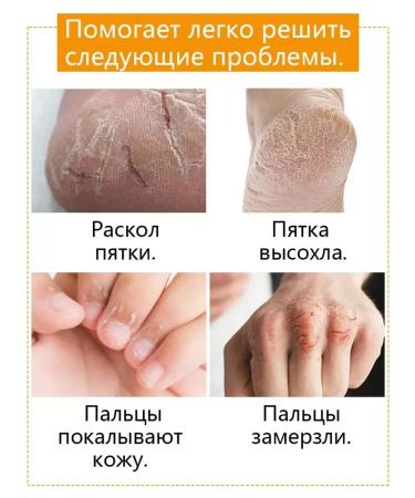 Cream from cracks and peeling - Buy Online on GoSupps.com