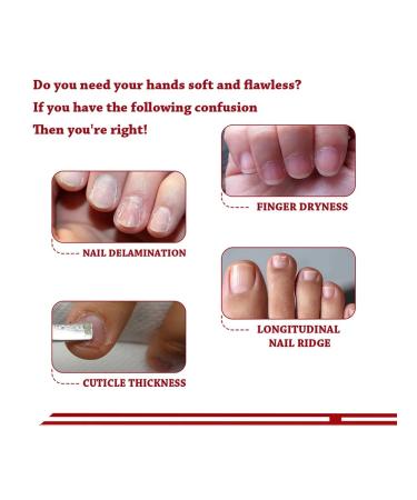 30ml Nail Care Essence Hydrating Natural Nail Serums Nail A - Buy Online on GoSupps.com