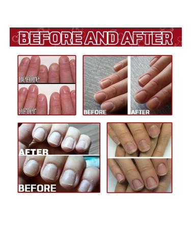 30ml Nail Care Essence Hydrating Natural Nail Serums Nail A - Buy Online on GoSupps.com