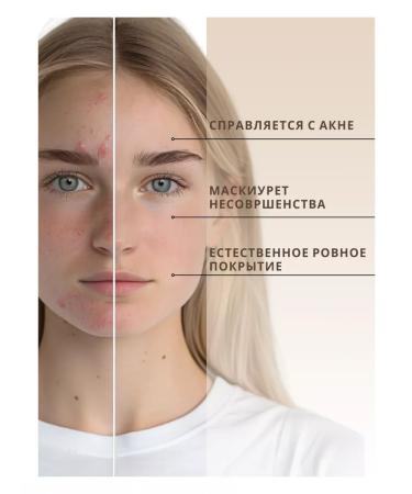 BELITA BB face cream Acne - Buy Online on GoSupps.com