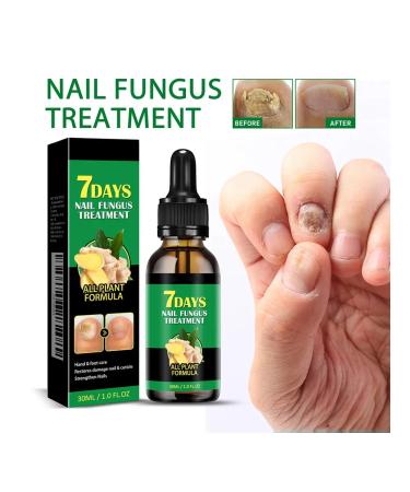 30ml oil for nail growth with ginger Clean care - Buy Online on GoSupps.com