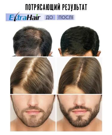 SeruZone Hair growth serum - Buy Online on GoSupps.com