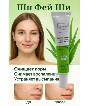 Warehouse77 Acne cream and acne for the face and body