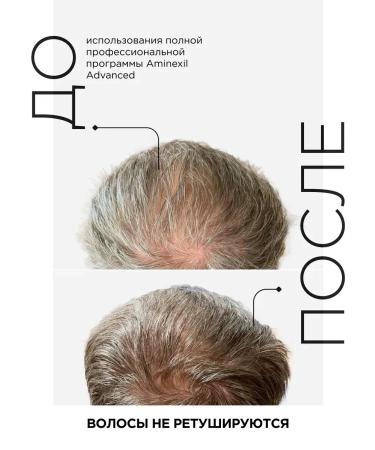 LotionPro Lotion-departure in monodoses from hair loss Aminexil 10 pcs - Buy Online on GoSupps.com