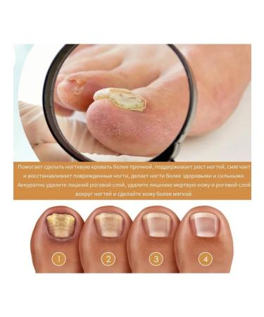 Eelhoe gel to remove cuticle to decorate your nails - Buy Online on GoSupps.com