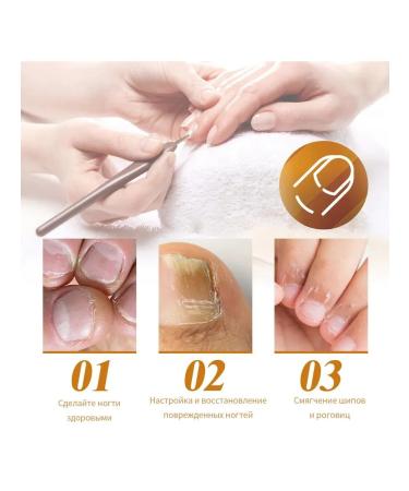 Nail fungus of the horn layer repair thickening moisturizes the gel - Buy Online on GoSupps.com