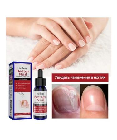 eelhoe Eliminate nail recovery fungi Delicate fluid 50 ml - Buy Online on GoSupps.com